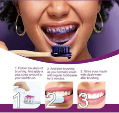 Smile Ease | ابتسامة سهولة