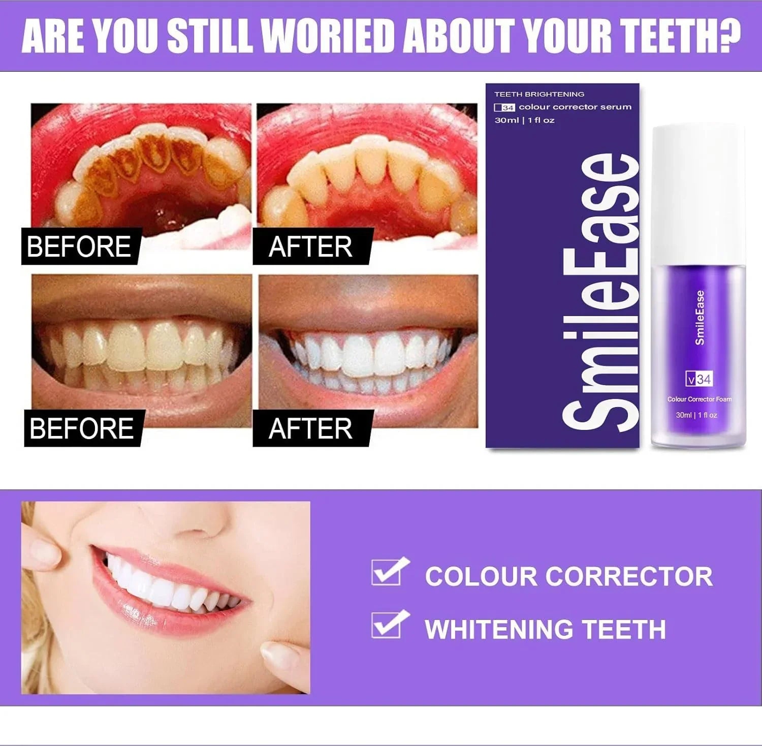 Smile Ease | ابتسامة سهولة